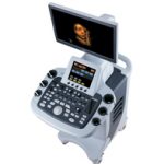 Siêu âm 4D(4 Chiều) Gò Vấp