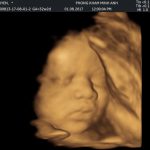 Rất đông sản phụ đã đến khám và nhận quà trong ngày khai trương