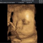 Các mẹ cho ý kiến gì về ảnh của con?